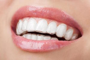 adult braces - never too late for a great smile