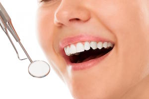 Why Tooth Coloured Fillings are Better for Your Smile