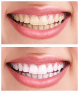 United Smiles | Cosmetic Dentistry - Dentist Mernda