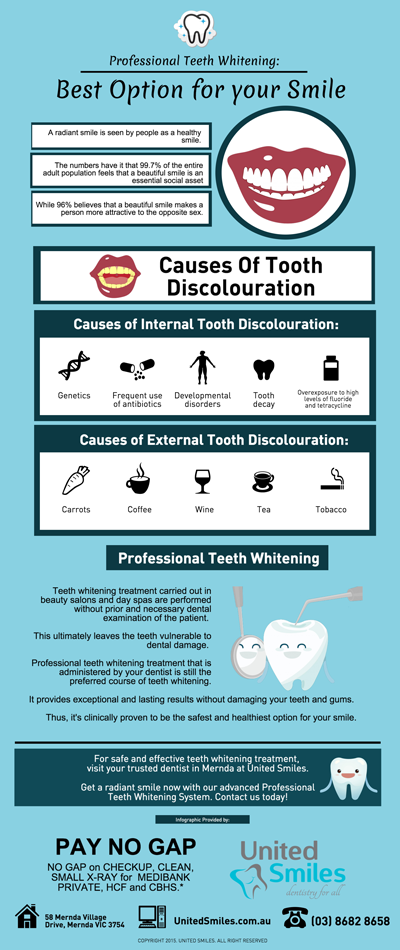 Professional-Teeth-Whitening-Best-Option-for-your-Smile-p