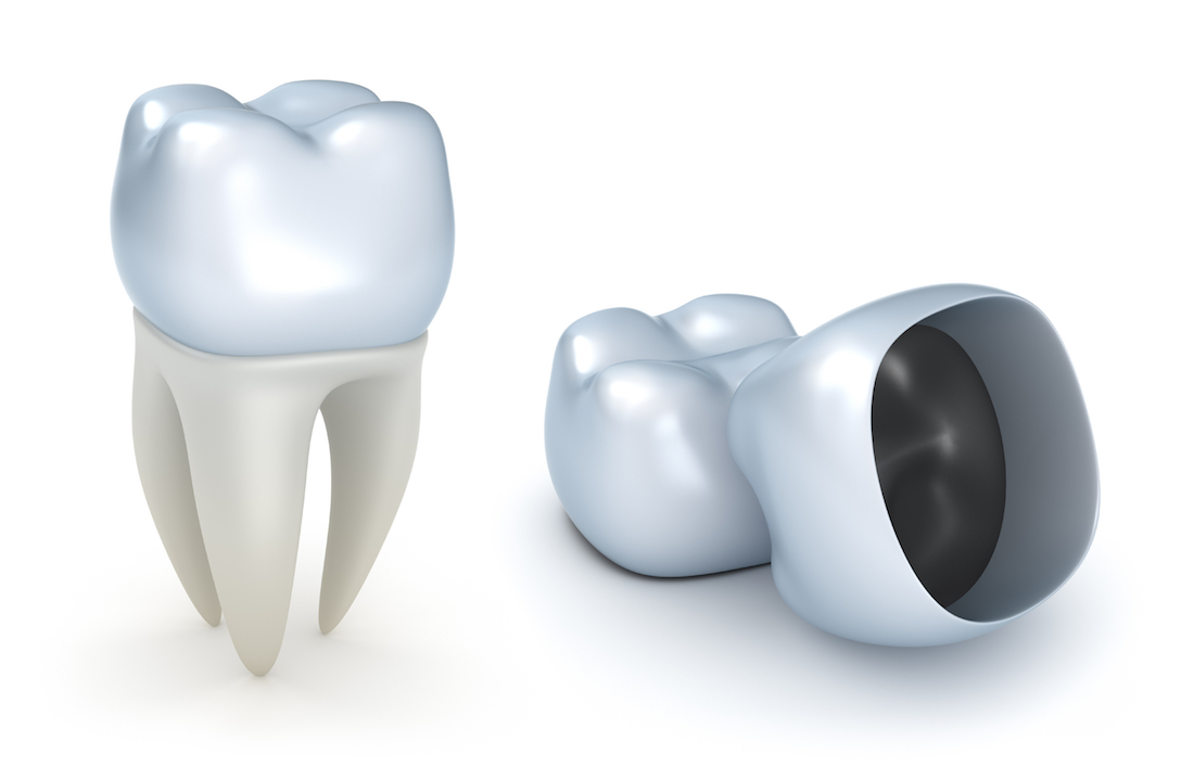 Dental Crown Multiple Functions, Multiple Benefits for your Smile