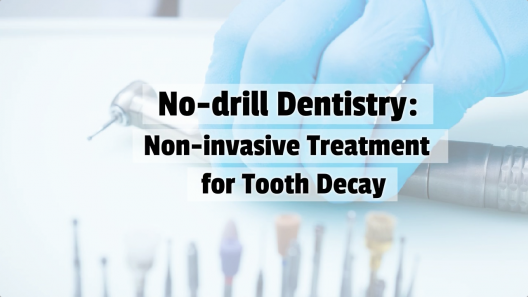 No-drill_Dentistry_Non-invasive_Treatment_for_Tooth_Decay