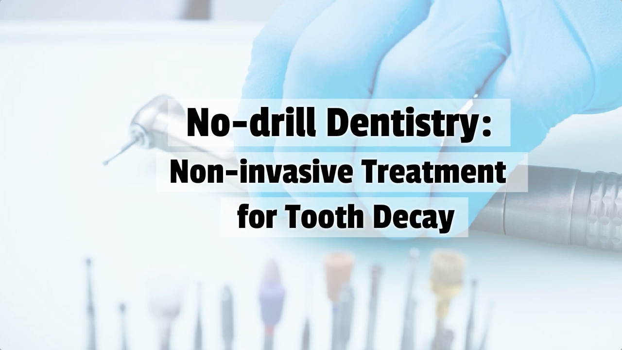 No-drill_Dentistry_Non-invasive_Treatment_for_Tooth_Decay
