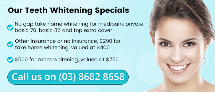 Our Teeth Whitening Specials Banner | Dentist Mernda