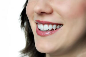 For Excellent Tooth Repairs Choose Porcelain Veneers in Mernda mernda dentist
