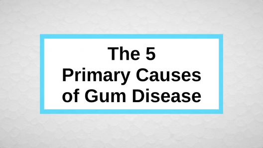 The 5 Primary Causes of Gum Disease