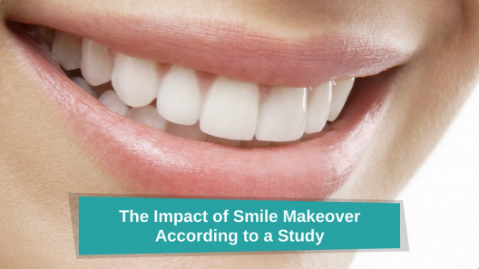The-Impact-of-Smile-Makeover-According-to-a-Study