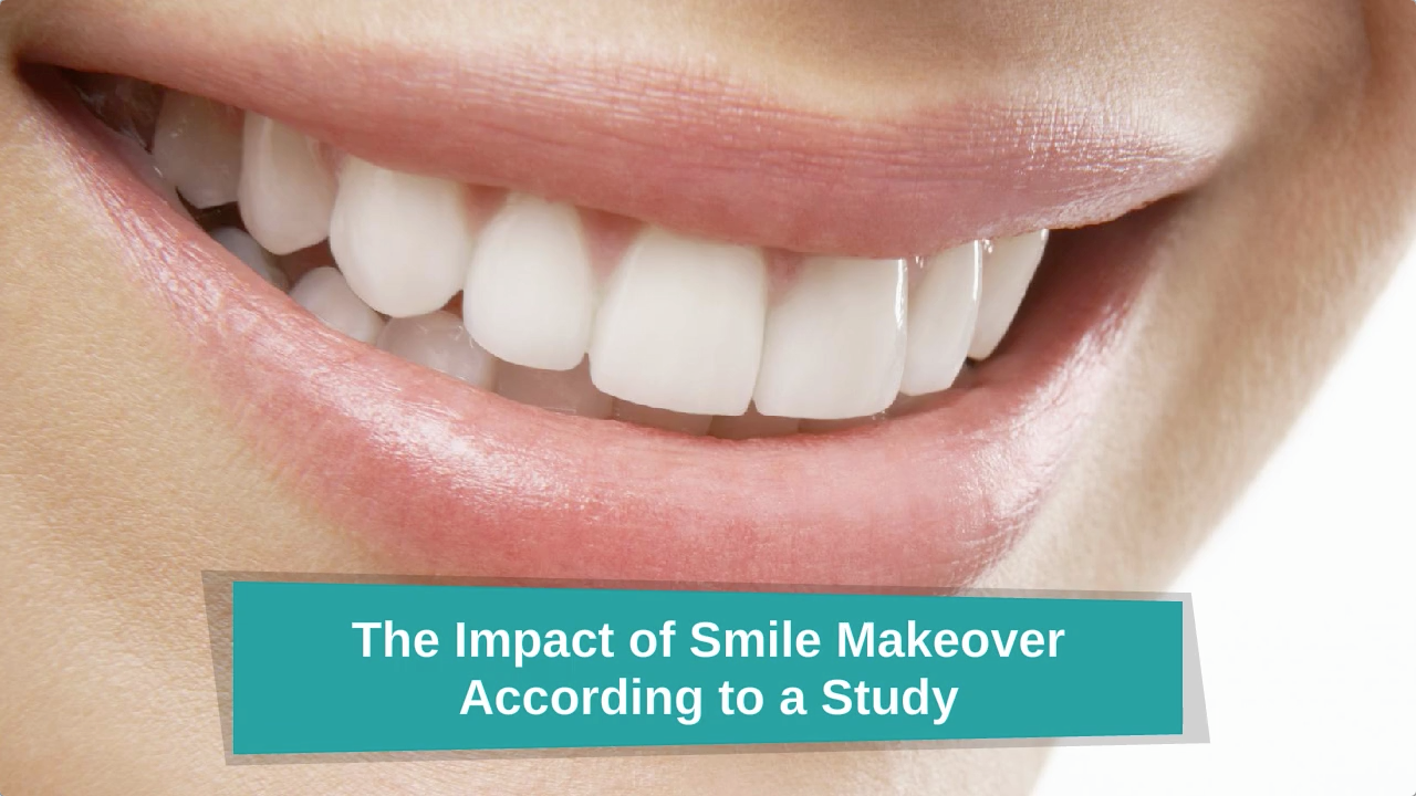 The-Impact-of-Smile-Makeover-According-to-a-Study