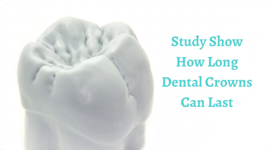 Study Show How Long Dental Crowns Can Last