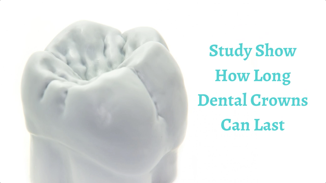 Study Show How Long Dental Crowns Can Last