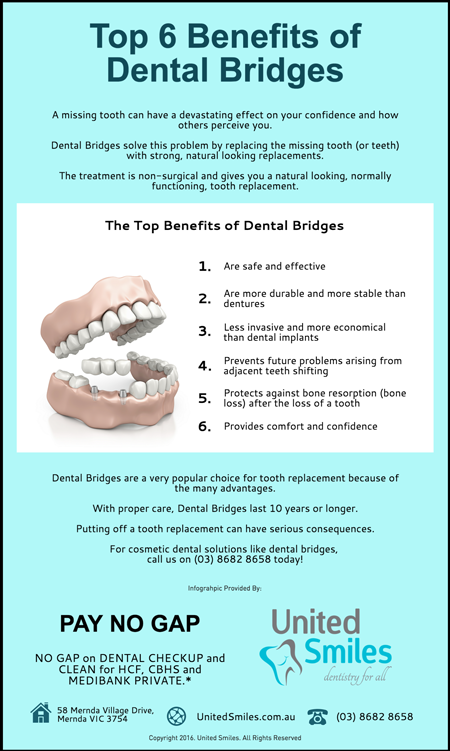 Top-6-Benefits-of-Dental-Bridges@2x