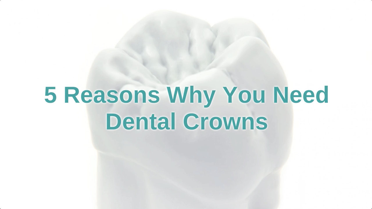 mernda-dentist-tips-5-reasons-why-you-need-dental-crowns