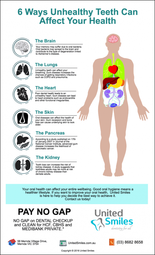 mernda-dentist-trivia-6-ways-unhealthy-teeth-can-affect-your-health2x Mernda Dentist Trivia: 6 Ways Unhealthy Teeth Can Affect Your Health