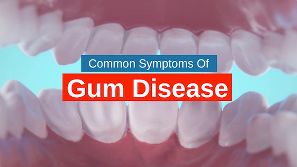 common-symptoms-of-gum-disease