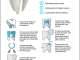Everything-You-Need-to-Know-About-Dental-Crowns
