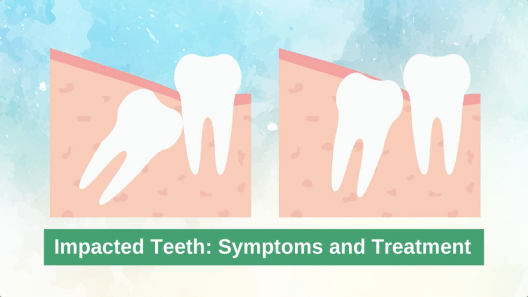 What are the Signs of Impacted Teeth
